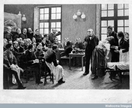 Jean Martin Charcot demonstrates hysteria in a patient at the Salpetriere, by Pierre Broulliert (1887)